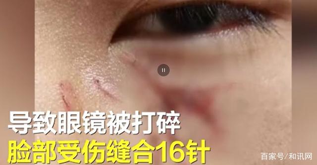 陕西老师殴打学生致其缝16针,到底谁该教育?