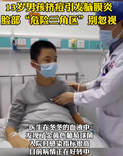 警惕：13岁小男孩挤痘痘引发脑膜炎